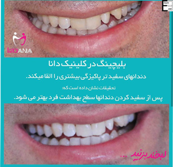 کلینیک دندانپزشکی دانا - رشت