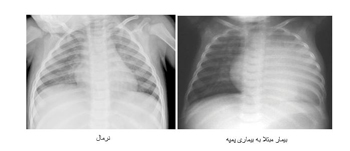 دکتر احیا زری دوست - فوق تخصص غدد رشت