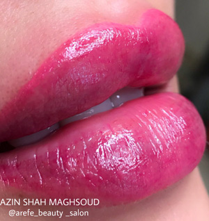 سالن زیبایی عارفه - رشت - گلسار سالن زیبایی عارفه - رشت - گلسار