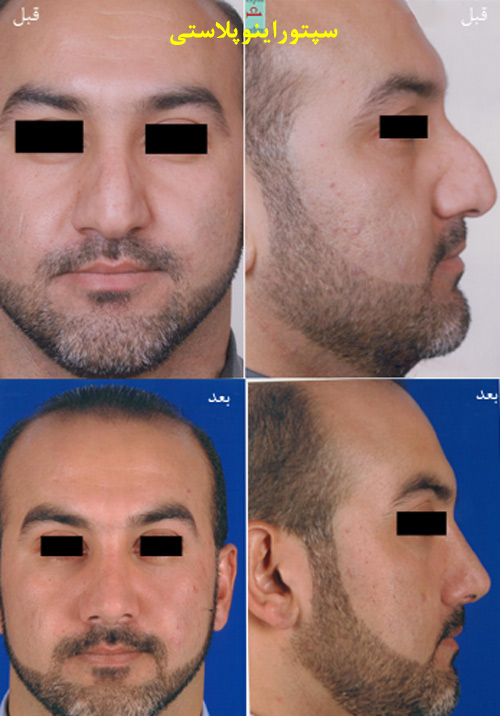 دکتر آریو شهبازی مقدم - فوق تخصص جراحی پلاستیک - رشت