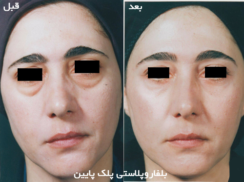 دکتر آریو شهبازی مقدم - فوق تخصص جراحی پلاستیک - رشت