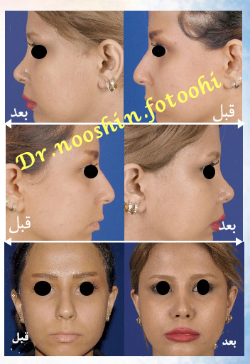 دکتر نوشین فتوحی - رشت