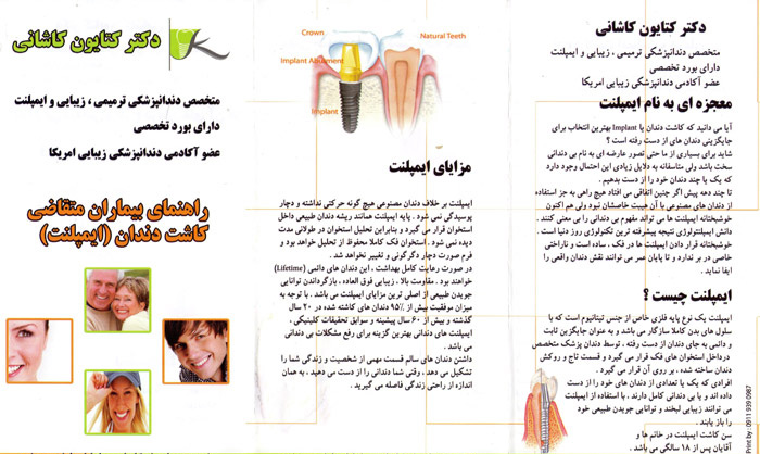 دکتر کتایون کاشانی - متخصص ایمپلنت رشت