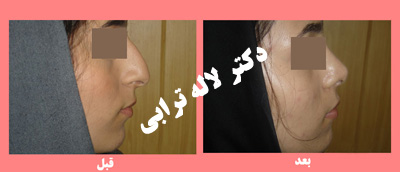 دکتر لاله ترابی - متخصص گوش و حلق و بینی - جراح زیبایی بینی رشت