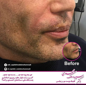 دکتر سپیده ملک محمدی - کلینیک پوست ، مو و زیبایی