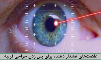 دکتر ساری محمدلی - متخصص چشم