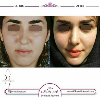 دکتر نوید رضوانی - فوق تخصص جراحی پلاستیک و ترمیمی