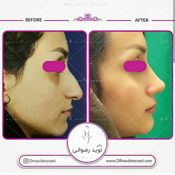 دکتر نوید رضوانی - فوق تخصص جراحی پلاستیک و ترمیمی