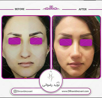 دکتر نوید رضوانی - فوق تخصص جراحی پلاستیک و ترمیمی