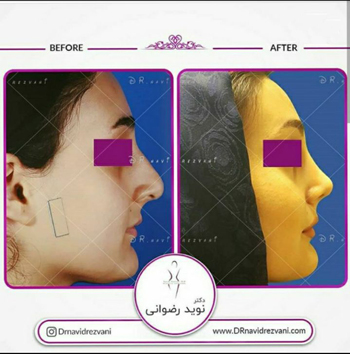 دکتر نوید رضوانی - فوق تخصص جراحی پلاستیک و ترمیمی