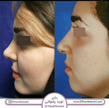 دکتر نوید رضوانی - فوق تخصص جراحی پلاستیک و ترمیمی