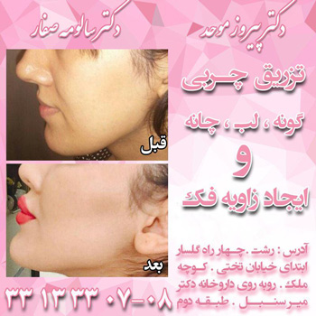 دکتر پیروز موحد - دکتر سالومه صفار - رشت