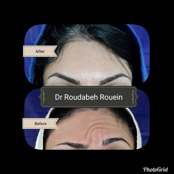 دکتر رودابه روئین - پوست، مو، زیبایی و لیزر در رشت