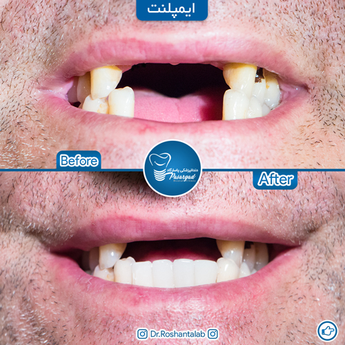 دکتر حسن روشن طلب - دندانپزشک رشت