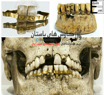 دندانسازی بهداد فرقان