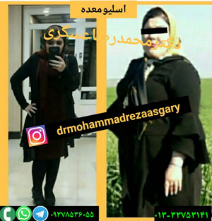 دکتر محمدرضا عسگری - جراحی چاقی در رشت