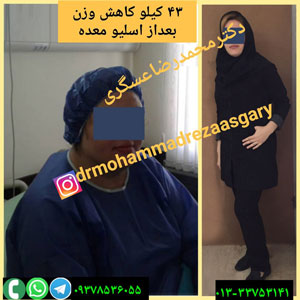 دکتر محمدرضا عسگری - جراحی چاقی در رشت